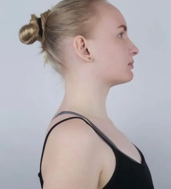 Neck posture after using the VivoSleep traction device